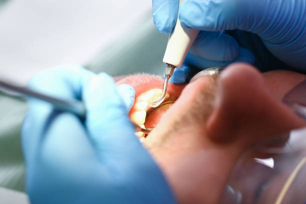 Best Emergency Treatment for Toothache in Lmdale, PA